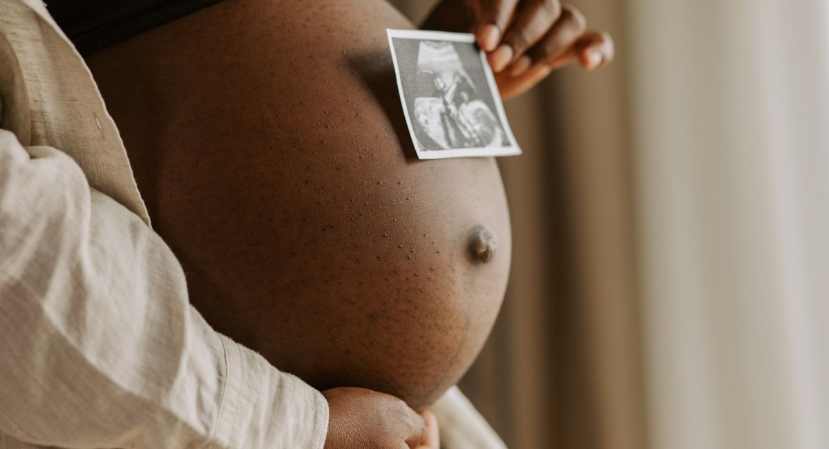 How Medi-Cal is Expanding Maternal Health Care: Doula Services and Innovations in California