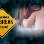 Measles Is Back. For Immigrant Families, the Real Threat Is a Crisis of Trust