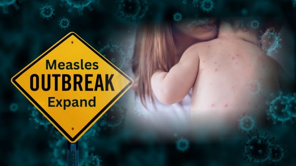 Measles Is Back. For Immigrant Families, the Real Threat Is a Crisis of Trust