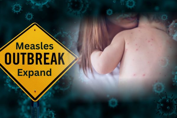 Measles Is Back. For Immigrant Families, the Real Threat Is a Crisis of Trust