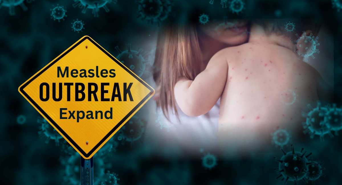 Measles Is Back. For Immigrant Families, the Real Threat Is a Crisis of Trust
